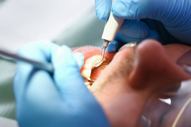 Best Pediatric Emergency Dentist in Parkland, WA