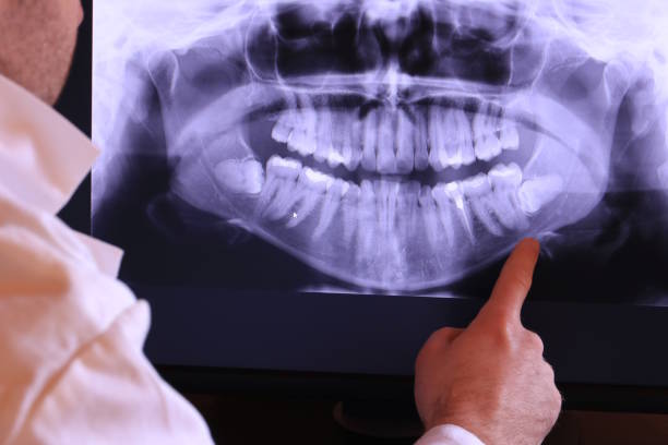 Best Mobile Emergency Dentist in Parkland, WA